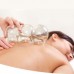 Holistic Hijama cupping treatments Holistic Hijama cupping treatments