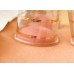 Holistic Hijama cupping treatments Holistic Hijama cupping treatments